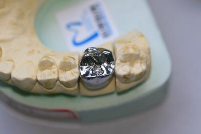 China El metal bajo del molde lleno alea la corona dental en venta