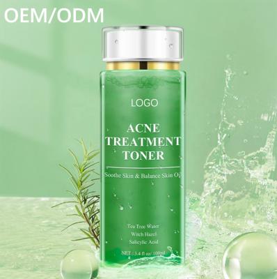 China Anti Acne Pure Natural Soft Facial Acne Treatment Soft Tea Tree Toner Deep Hydration Skin Toner for sale