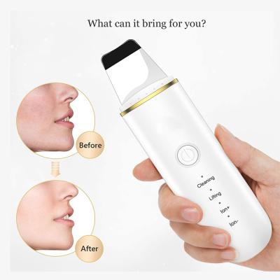 China Ultrasonic Peeling Machine Facial Spatula Skin Scrubber DEEP CLEANSING Ultrasonic Scraper and Soft Skin Device for sale