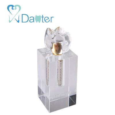 China Hospital Clinic University Success Crystal Implant Removable Teeth Model Dental Implant Model For Demonstration for sale