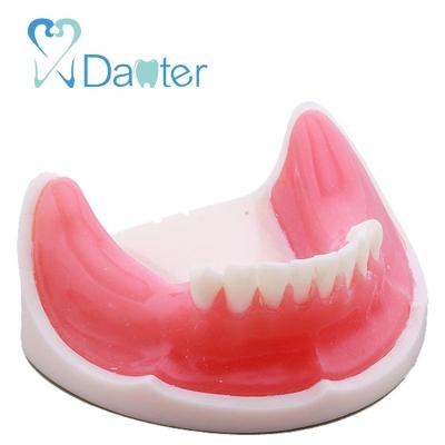 China Hospital Clinic University Most Popular Implant Practice Mandibular Jaw Model For Dentist Practice for sale