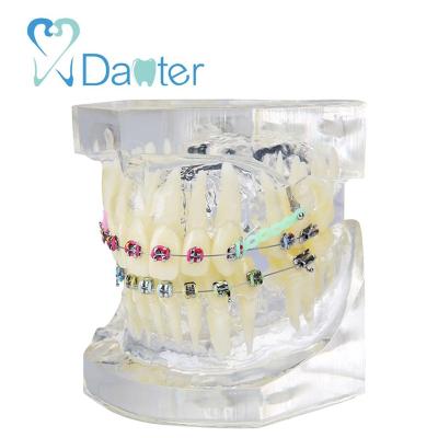 China High Quality Hospital Clinic University Dental Orthodontic Model With Metal Bracket For Patients Communication for sale