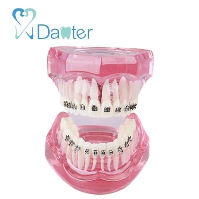 China Fantastic Quality Hospital Clinic University Dental Orthodontic Model With Metal Bracket For Demonstation for sale