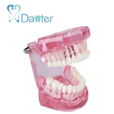 China 2018 Hot Sale New Hospital Clinic University Dental Orthodontic Model With Ceramic Bracket For Dental Clinic And Lab for sale