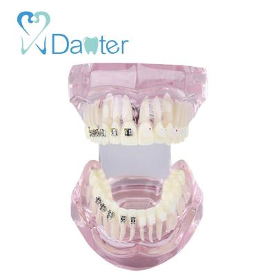 China Hospital Clinic University New Arrival Dental Orthodontic Model With Metal And Ceramic Bracket for sale