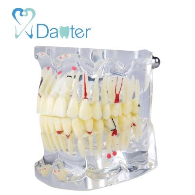 China University of hospital clinic most popular dental adult pathologies model for demonstration and study for sale