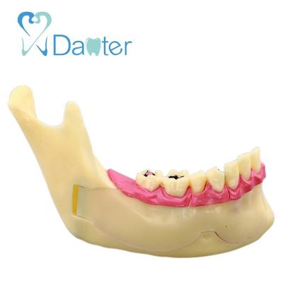 China 2018 Hospital Clinic University Top Selling Dental Natural Teeth And Jaw Lower Jaw Model For Dental Demonstration for sale