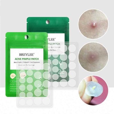 China Personal Care Acne Tool Care Pimple Correction for sale