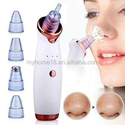 China Amazon Hot Selling 3 Level Black Head Electric Pore Remover Blackhead Removal Suction Extractor Tool Kit Acne Blackhead Remover Vacuum for sale