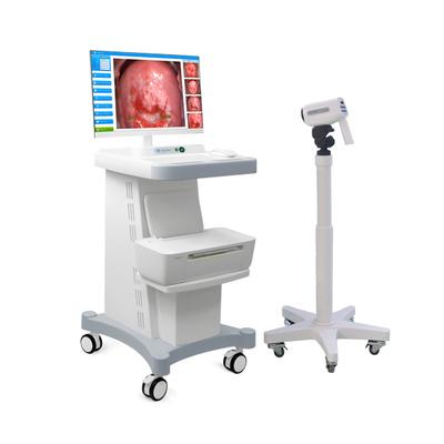 China Gynecology Digital Video Colposcope for sale