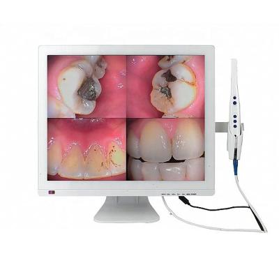 China M-978 Dental Regional Dental Oral Camera System (17inch PC Monitor) for sale