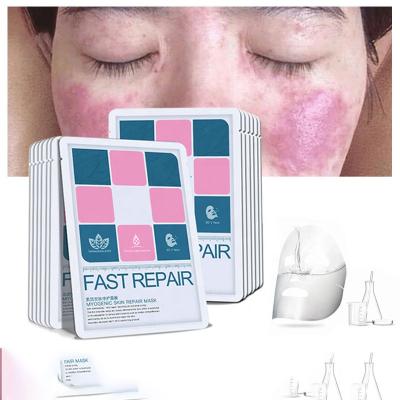 China Acne Moisturizer Sheet Mask Natural Organic Brightening Hydration Silk Face Mask - Skin Care Facial Aid for sale