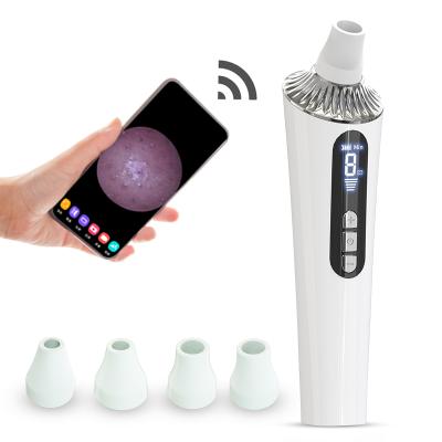 China Mini Black Head Removal Vacuum Electric Visual Blackhead Remover With Camera Acne Blackhead Remover for sale