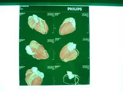 China Filme seco médico de X Ray de Digitas, Dt2b/filme seco médico imagem latente de Dt1b Agfa à venda