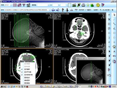 Chine 8 représentation diagnostique médicale du laser X Ray de papier de x 10inch pour KND-DRYTEC 4000 à vendre