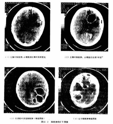 Cina A 8×10 pollici di carta medico Del film asciutto trasparente della stampante a laser X Ray in vendita