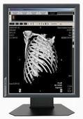 Cina 850cd/m2 il tipo grado medico di luminosità visualizza 20,1» dimensioni G51SP in vendita