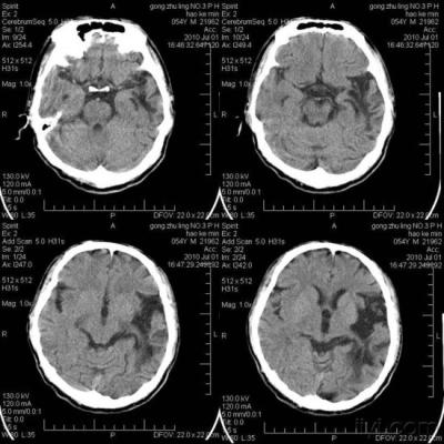 China Kratzer-beständige medizinische Bildgebung X Ray für Konida Laserdrucker zu verkaufen