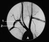 China Konida Medical X Ray Films for sale