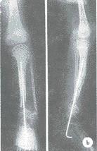 China Wasserdichtes trockenes medizinisches X Ray filmt Konida, das für AGFA/Fuji glatt ist zu verkaufen