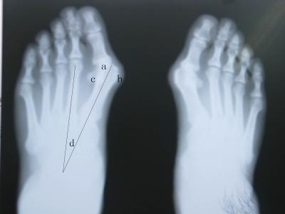 Chine Anti éraflure de représentation diagnostique professionnelle du laser X Ray pour l'imprimante de KODAK/FUJI/AGFA à vendre