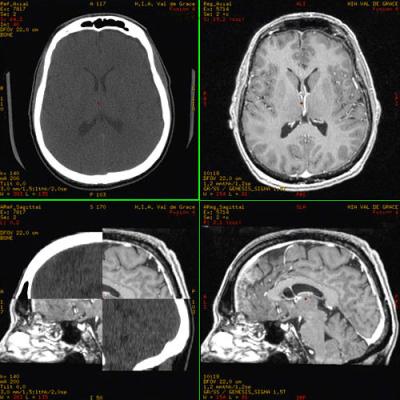 China Thermal-Drucker Film mit hoher Dichte, Film Blatt A3/A4 HAUSTIER Kasten-X Ray zu verkaufen