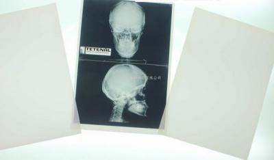 China Konida 10in X 12in X Ray Medical Imaging Te koop