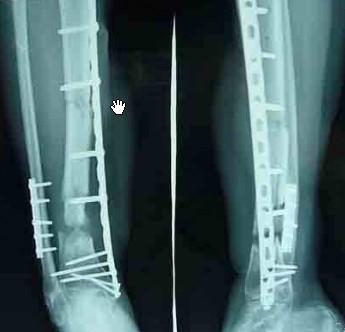 Cina Rappresentazione diagnostica medica della stampante a laser della carta X Ray per l'ospedale in vendita