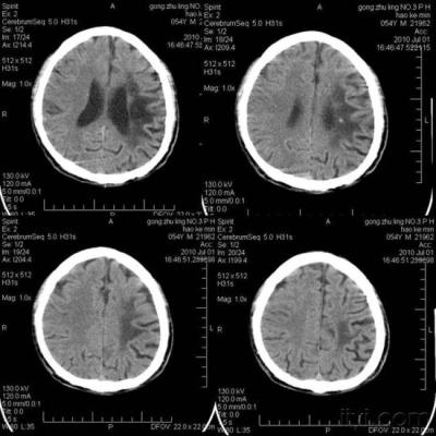 Cina Film asciutto 8in * 10in di rappresentazione di Fuji Agfa, X Ray e film termico medico per la stampante di DICOM in vendita