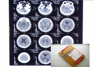 China STREICHELN Sie medizinischen Film-Stall Digital-X Ray mit Thermal-Druckern Agfa/Fujis zu verkaufen