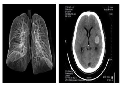 China Blaues HAUSTIER medizinischer Film 14 x 17in Agfa Drystar 5503 X Ray für Hosipital zu verkaufen