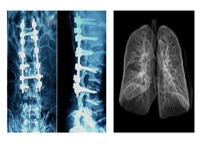 China Scharfe radiografische medizinische Filme X Ray, Film Mri Dr.-Ct Digital Dry Imaging zu verkaufen