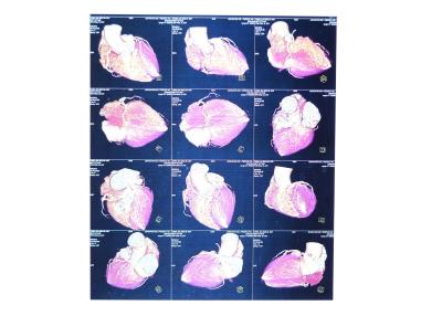 China Altas películas del papel de la radiografía de la agudeza, películas termales médicas de Agfa Dt2b Fuji en venta