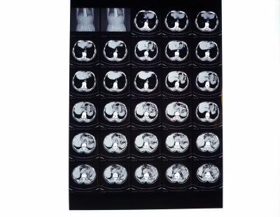 China Película de alta densidad de X Ray de Digitaces en venta