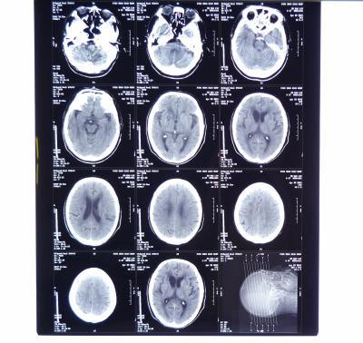 China Película de Fuji/de Agfa X Ray, película seca médica de la impresora de los 8in del x 10in Termal en venta