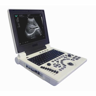 China Van de Kleurendoppler van OB GYN Draagbare de Ultrasone klankmachine in Zwangerschap Te koop