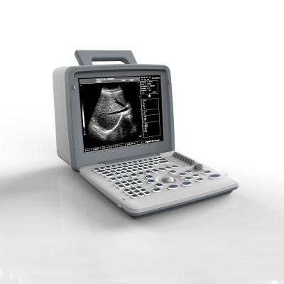 중국 가득 찬 디지털 OB GYN USG 스캔 기계 0 내지 120dB 12in LED 디스플레이 판매용