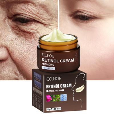 China Free Sample Stored Anti Freckle Whitening Deep Moisturize Removal Dark Spot Corrector Skin Anti Black Spot Remover Face Cream for sale