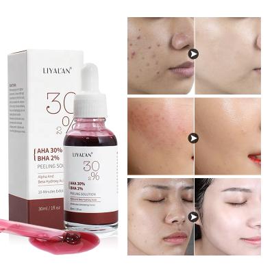 China Exfoliante AHA 30% Exfoliante AHA 30% Acne AHA Solution Wholesale Skin Care Natural Korean Face Serum Anti Moisturizer for sale