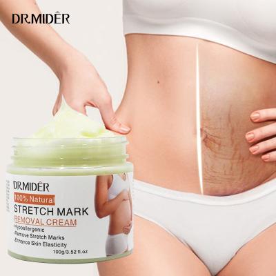 China High Quality Natural Extract Body Skin Revitalizer Free Samples Skin Tightening Safe Effective Firming Remove Stretch Mark Treatment Cream for sale