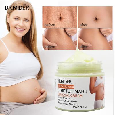 China Skin Revitalizer 2022 Hot Selling New Products 100% Natural Safe Postpartum Pregnancy Cream Scar Repairing Anti Stretch Marks Removal Cream for sale