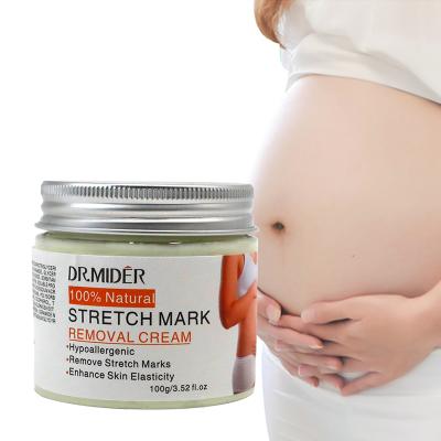 China Organic Natural Soft Moisturizer Pregnancy Mark Treatment Cream Maternity Repair Stretch Marks Removal Cream Non-irritating for sale