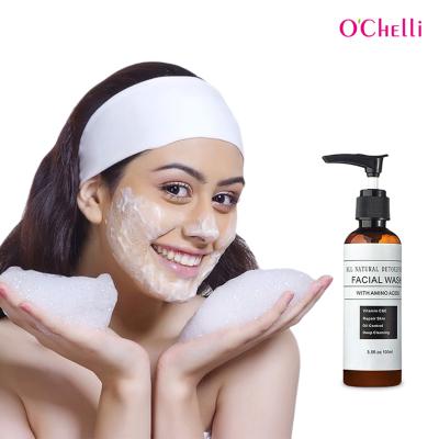 China Acne Treatment Oil Control Acne Treatment Deep Cleansing Skin Face Oily Wash for sale