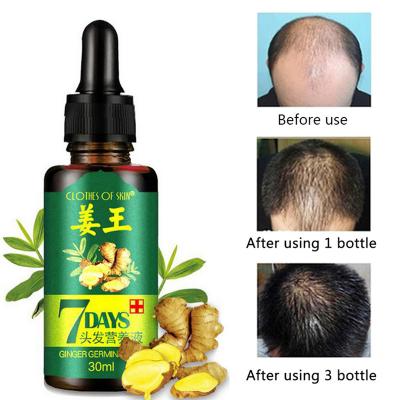 China 30ml Hair Growth Serum Esence for Women and Men Anti preventing Hair Loss alopecia Liquid Damaged Hair Repair Growing Faster for sale