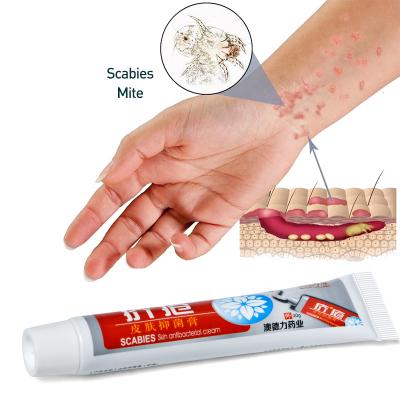 China Pubic Lice Cream Scabies Lice Removal Killer Psoriasis Pruritus Anti-Itch Antibacterial Herb Ointment Medical Plaster for sale