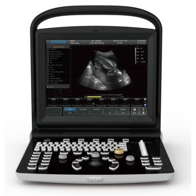 China Wholesale Price China Plastic Ultrasound Machine With 12 Inch Led Monitor for sale