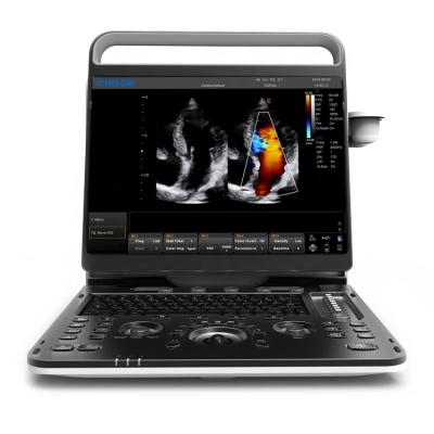 China 15 Inch Plastic High Resolution Led Monitor Chison Portable Ultrasound Machine Machine for sale