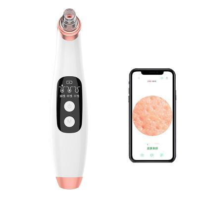 China Hot Selling Acne Treatment Amazon WIFI Blackhead Remover Vacuum Pore Remover HD Camera Beauty Device Vacuum Blackhead Remover for sale