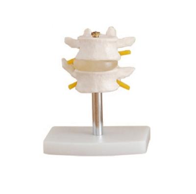 China Set Human Lumbar Vertebra Model Bone Teaching Lumbar Human Skeletal Model (2 Pcs) for sale