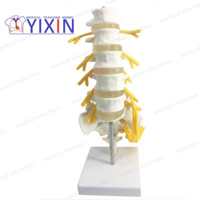 China Durable YIXIN lumbar spine / with sacrum and caudal equina for sale